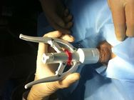 Circulair visueel circumflastisch besnijdenisapparaat voor mannen